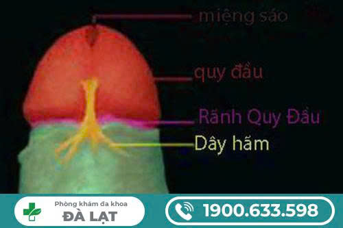 Hình ảnh minh họa